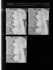 Five in a Family Having Tonsils Removed (3 Negatives) (March 13, 1954) [Sleeve 33, Folder c, Box 3]